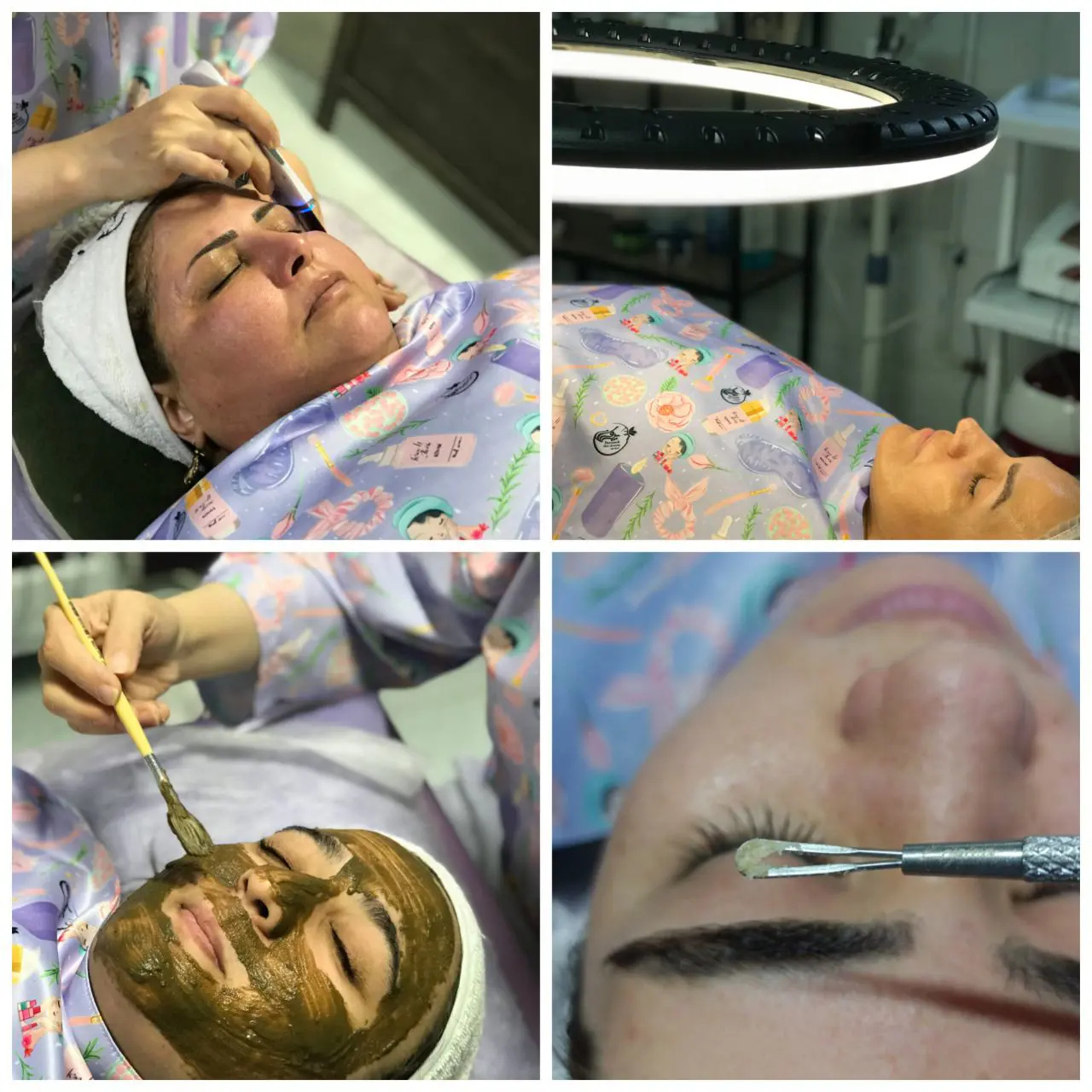 فیشال صورت 5