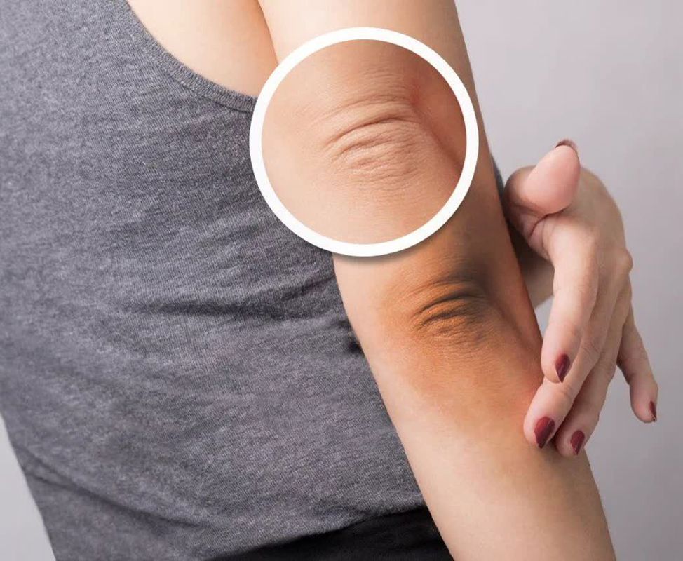 تیرگی های بدن